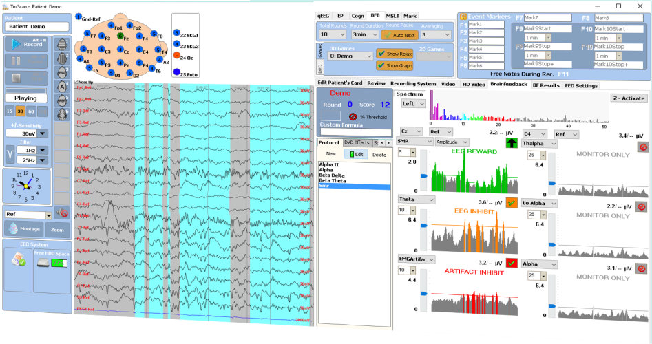 TruScan Neurofeedback Acquisition