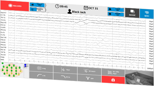 TruScan EEG aquisição em modo de UCI