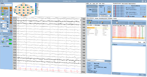 Aquisição de TruScan EEG